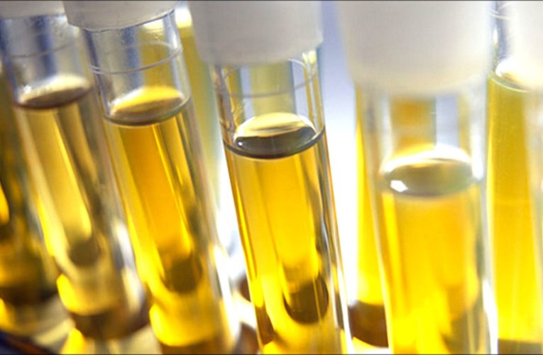 What Exactly Does Synthetic Urine Refers To