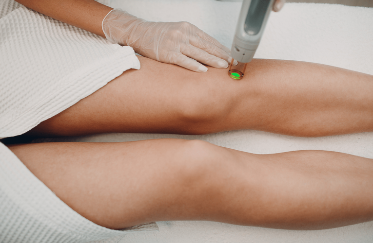 What Are the Major Benefits of Laser Hair Removal?